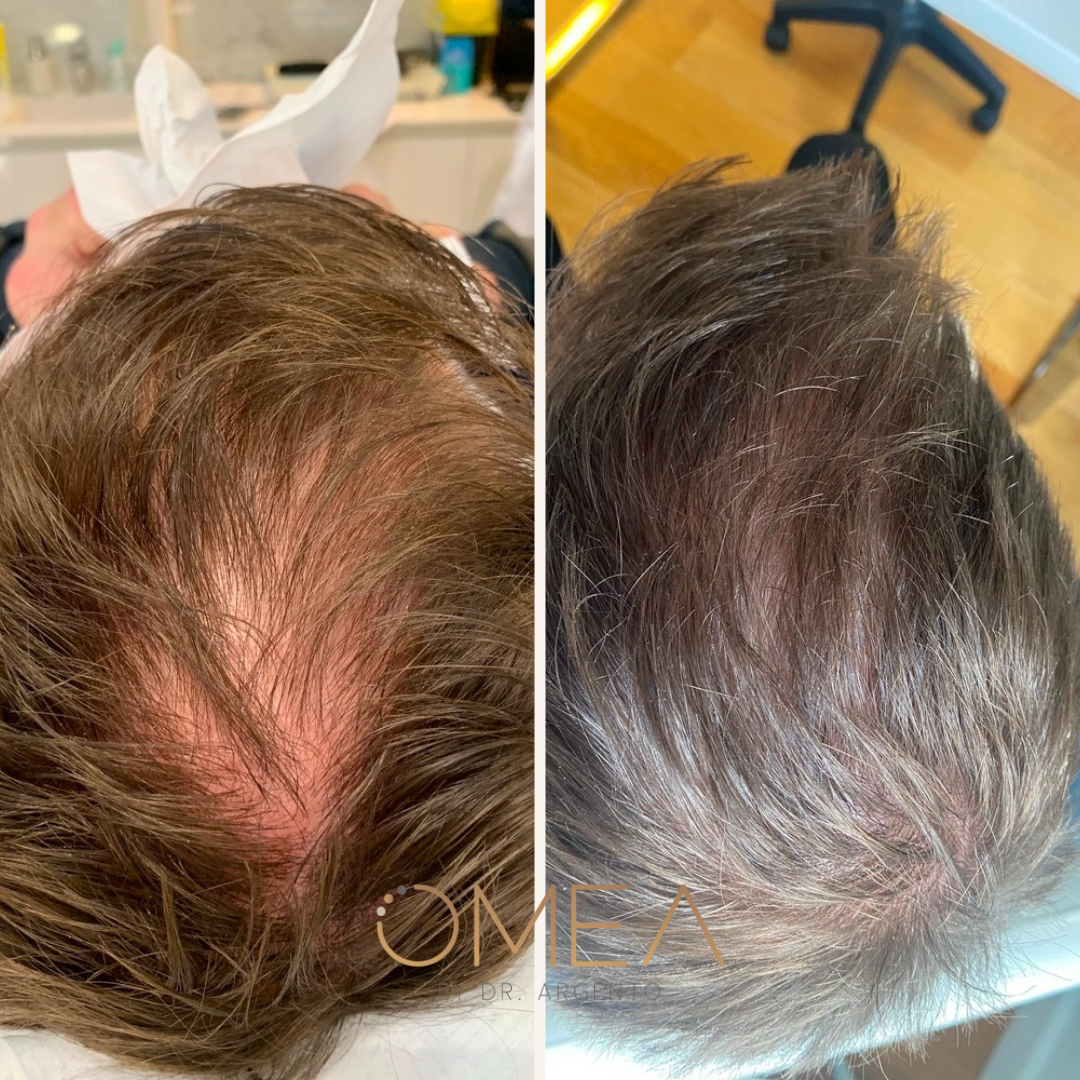 Ontwerp zonder titel (7)